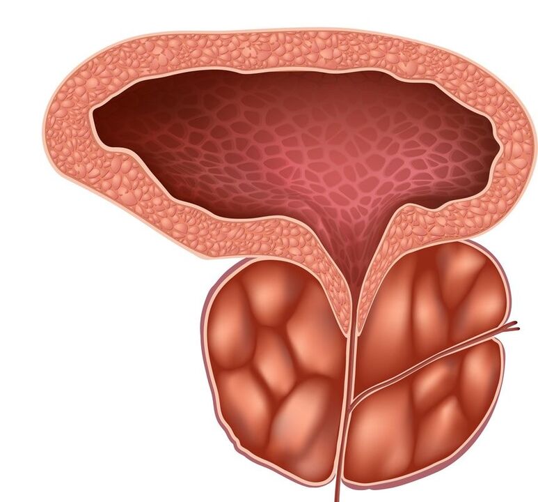 Prostata infiammata che Prostaline può affrontare